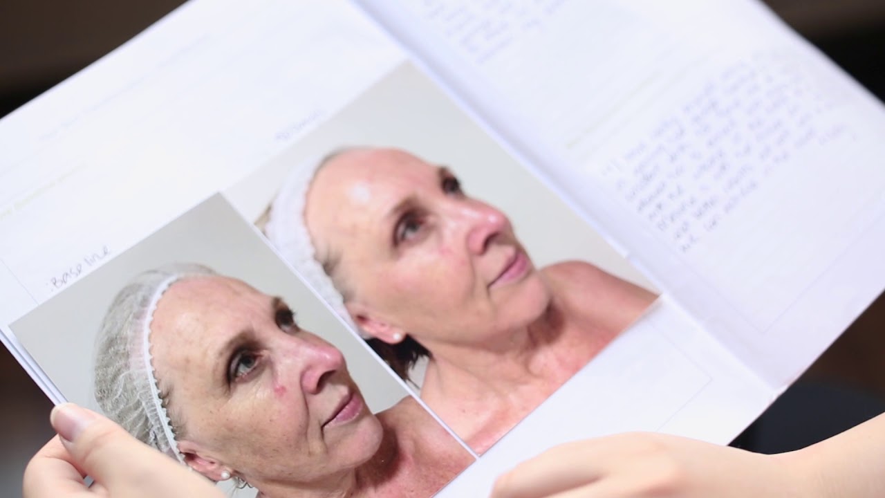 Maxine, 61 Anti-Ageing